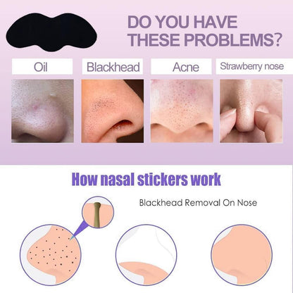 Blackhead Remover Strips (Pack of 20)