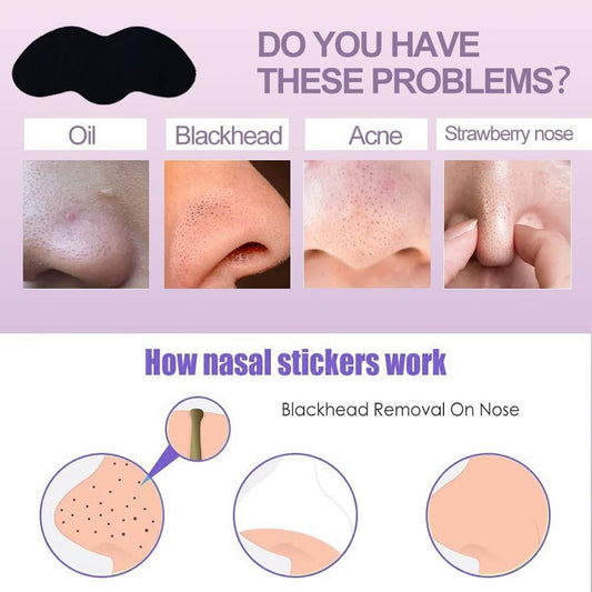 Blackhead Remover Strips (Pack of 20)