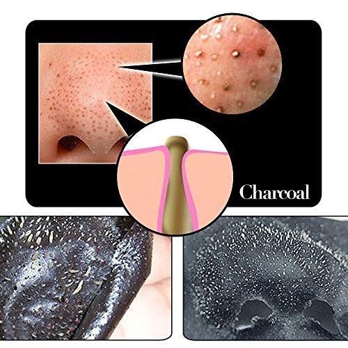 Blackhead Remover Strips (Pack of 20)